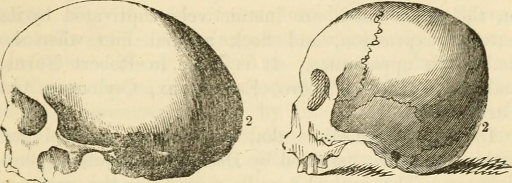 An illustration from Elements of phrenology, 1850, leaf 79
