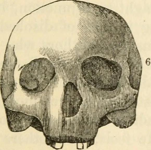An illustration from Elements of phrenology, 1850, leaf 87