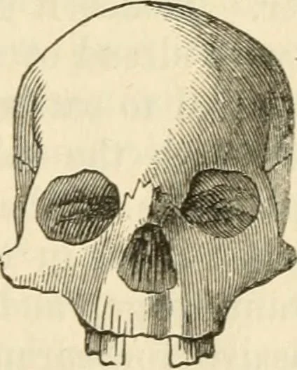 An illustration from Elements of phrenology, 1850, leaf 87