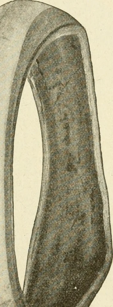 An illustration from Engelman's autocraft; being an instructive study of the automobile; its care and management; how to drive; locating troubles and repairing them; with chapters exploiting some of the latest devices used in automobile construction, 1914, leaf 56
