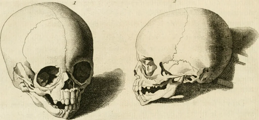 An illustration from Essai sur la physiognomonie : destiné a faire connoître l'homme & à le faire aimer, 1781, leaf 203