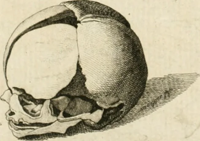 An illustration from Essai sur la physiognomonie : destiné a faire connoître l'homme & à le faire aimer, 1781, leaf 203