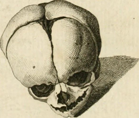 An illustration from Essai sur la physiognomonie : destiné a faire connoître l'homme & à le faire aimer, 1781, leaf 203