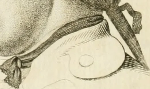 An illustration from Essai sur la physiognomonie : destiné a faire connoître l'homme & à le faire aimer, 1781, leaf 409
