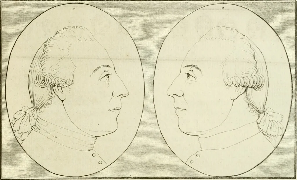 An illustration from Essai sur la physiognomonie : destiné a faire connoître l'homme & à le faire aimer, 1781, leaf 170