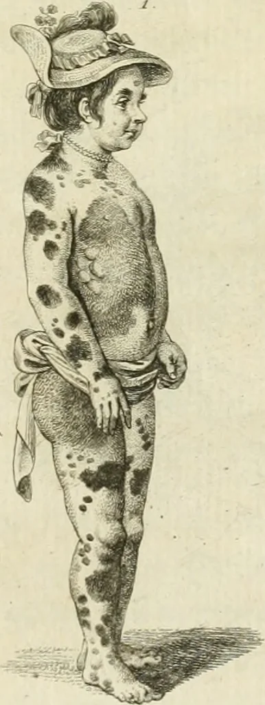 An illustration from Essai sur la physiognomonie : destiné a faire connoître l'homme & à le faire aimer, 1781, leaf 200