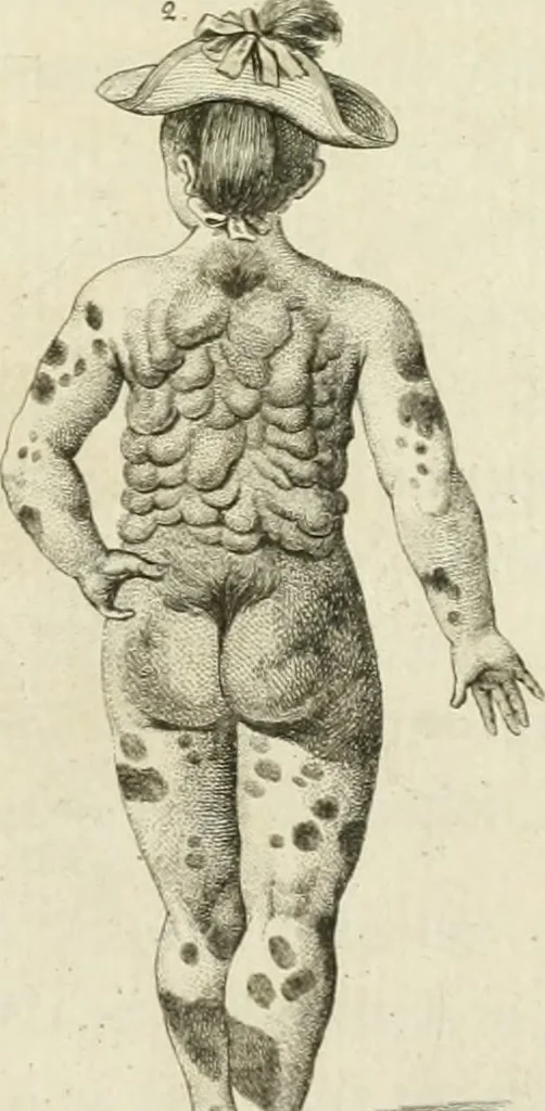 An illustration from Essai sur la physiognomonie : destiné a faire connoître l'homme & à le faire aimer, 1781, leaf 200