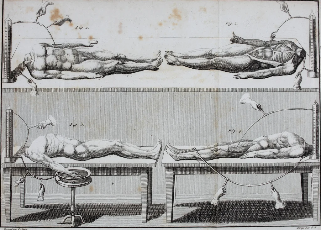 An illustration from Essai théorique et expérimental sur le galvanisme : avec une série d'expériences faites en présence des commissaires de l'Institut national de France, et en divers amphithéatres anatomiques de Londres, 1804, leaf 382