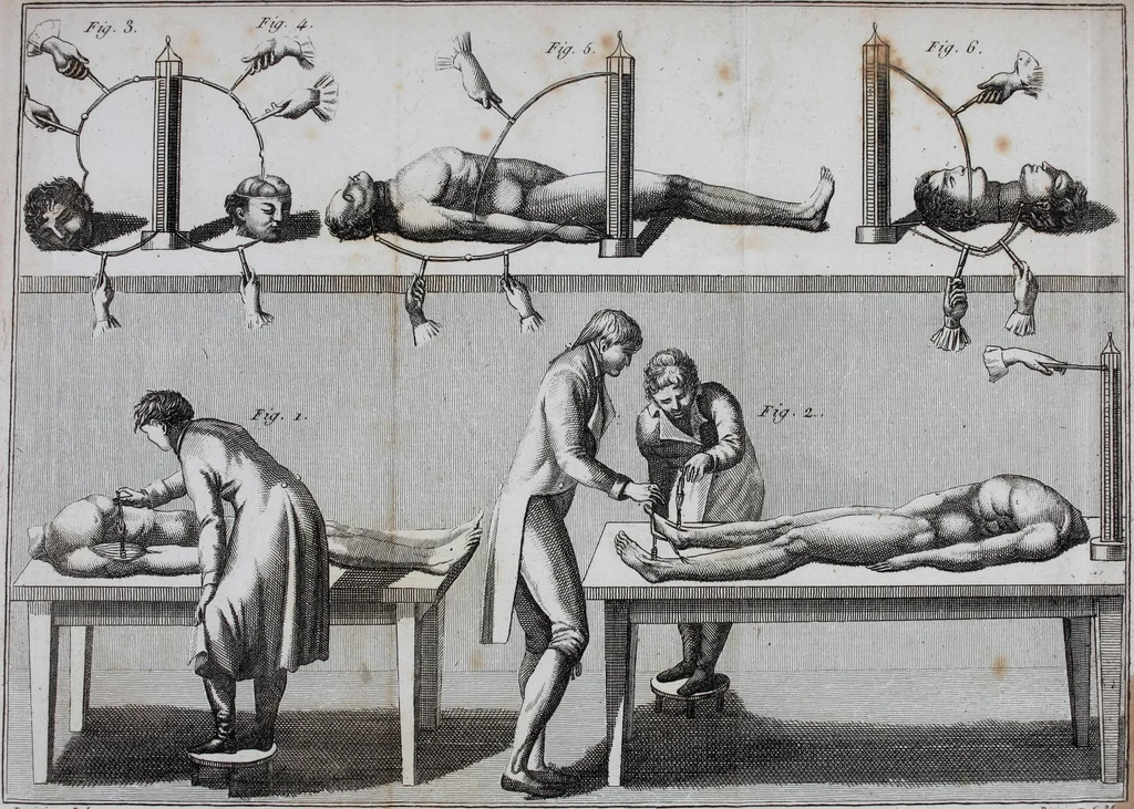An illustration from Essai théorique et expérimental sur le galvanisme : avec une série d'expériences faites en présence des commissaires de l'Institut national de France, et en divers amphithéatres anatomiques de Londres, 1804, leaf 384