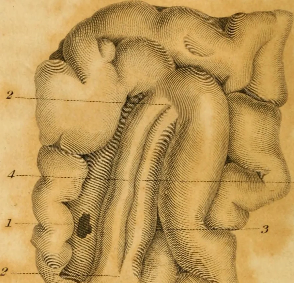 An illustration from Essays on phrenology : or an inquiry into the principles and utility of the system of Drs. Gall and Spurzheim, and into the objections made against it, 1822, leaf 202