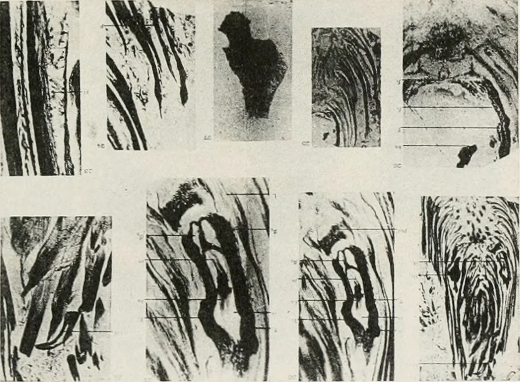 An illustration from The essentials of illustration, a practical guide to the reproduction of drawings & photographs for the use of scientists & others, 1915, leaf 50