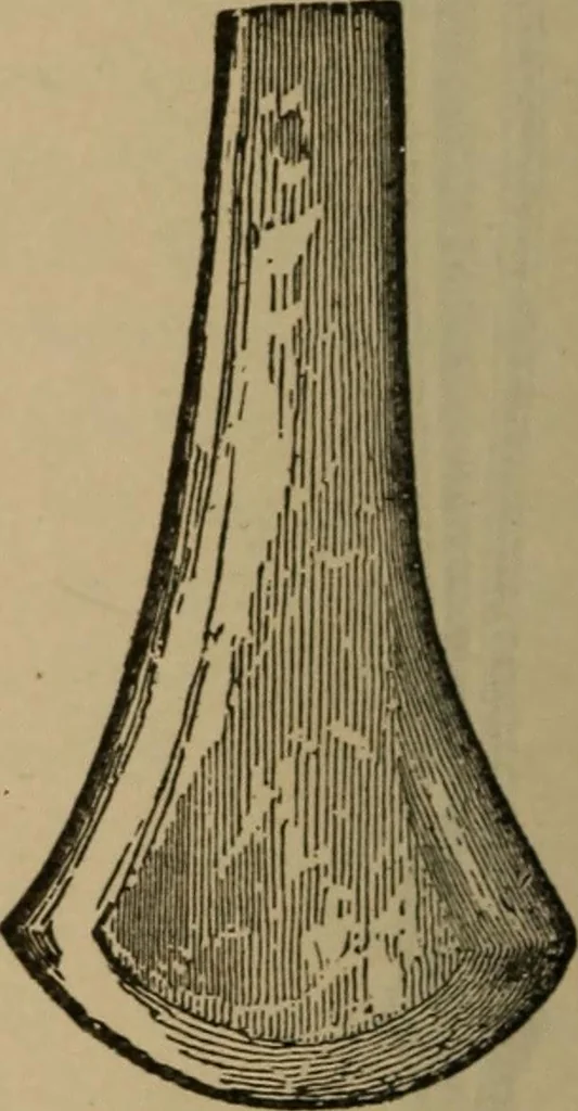 An illustration from Ethics of boxing and manly sport, 1888, leaf 204
