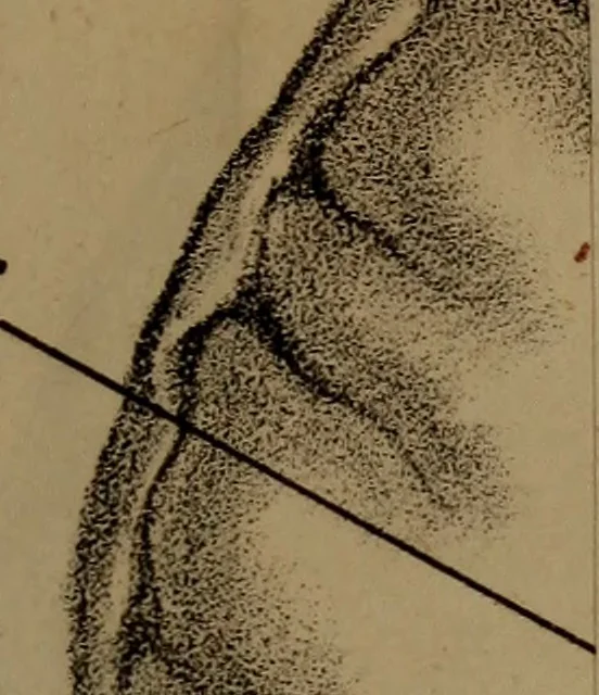 An illustration from An examination of phrenology;, 1837, leaf 82