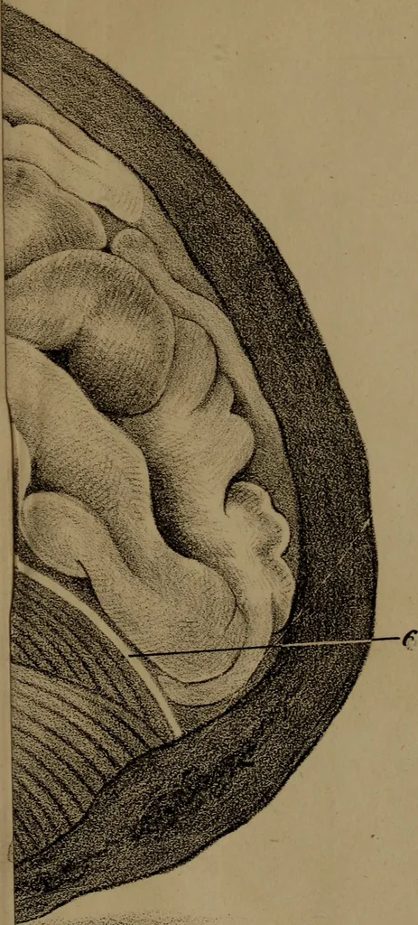 An illustration from An examination of phrenology;, 1837, leaf 90