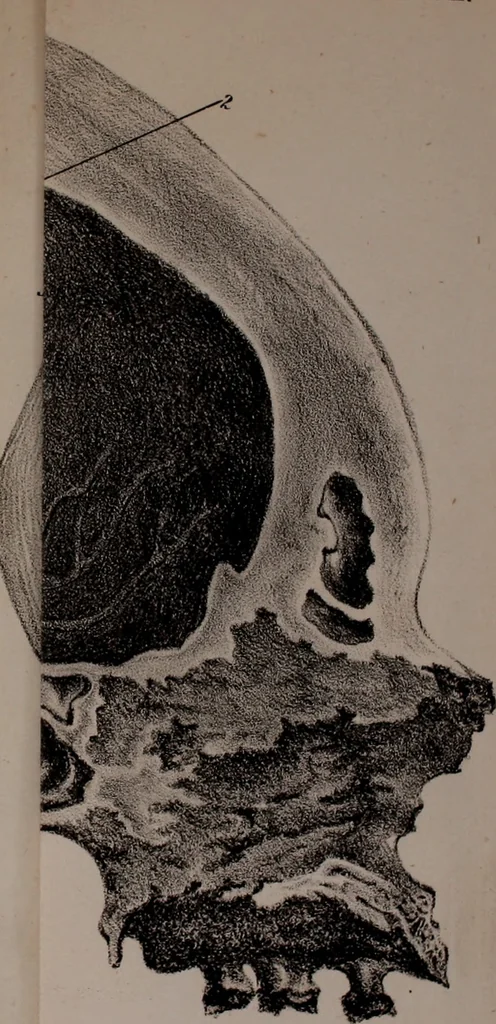 An illustration from An examination of phrenology;, 1837, leaf 98