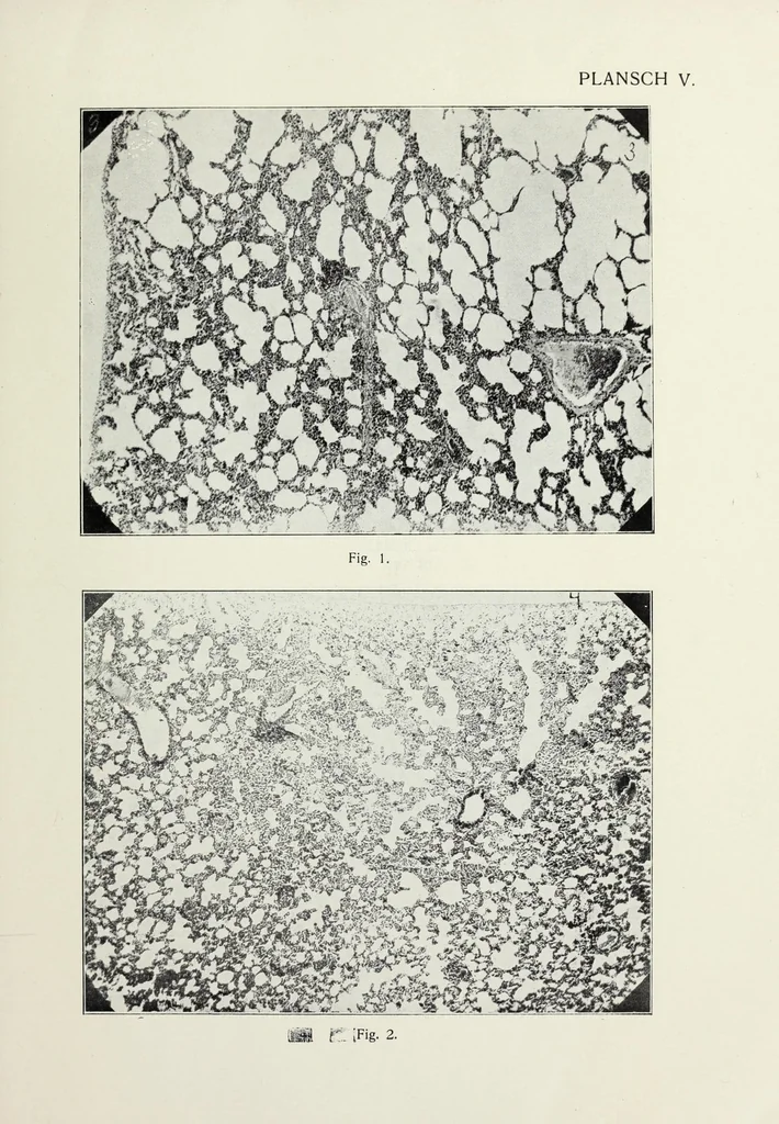 An illustration from Förgiftning genom torkande eller uppvärmd oljefärg, 1919, leaf 81