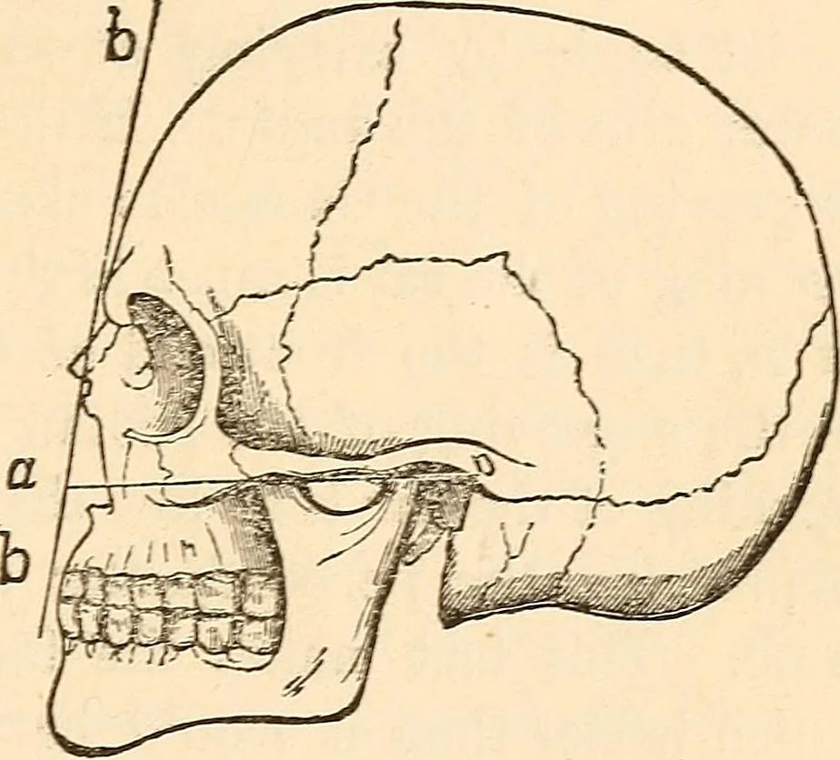 An illustration from Forty years in phrenology; embracing recollections of history, anecdote, and experience, 1888, leaf 403