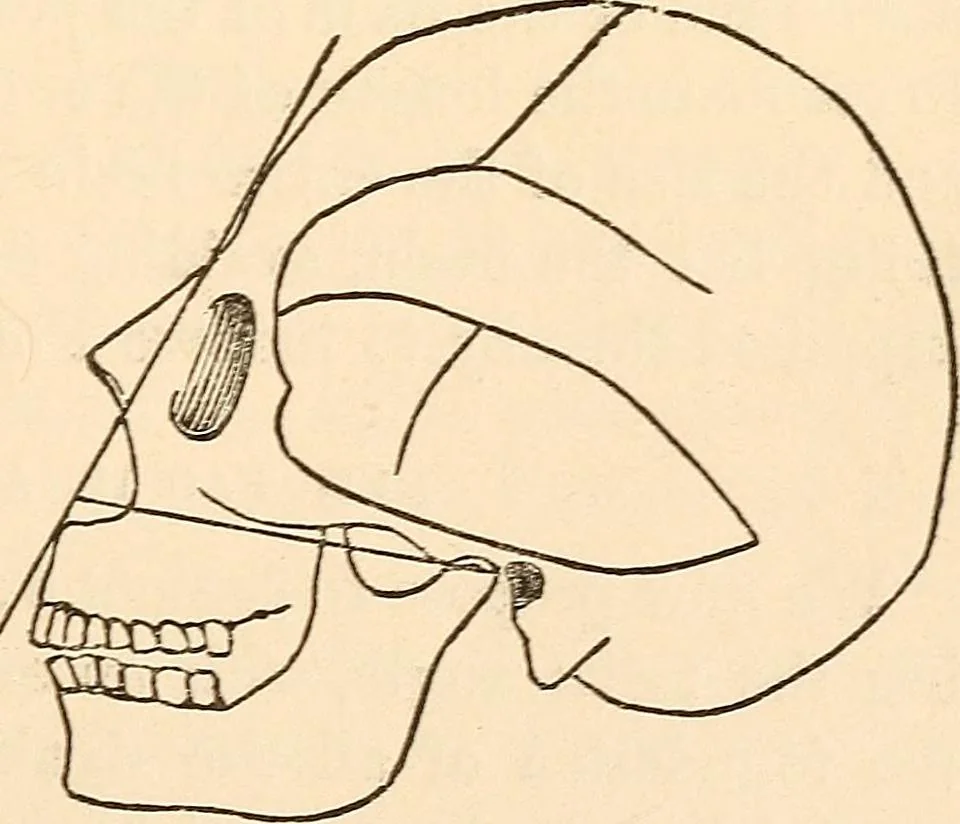 An illustration from Forty years in phrenology; embracing recollections of history, anecdote, and experience, 1888, leaf 403