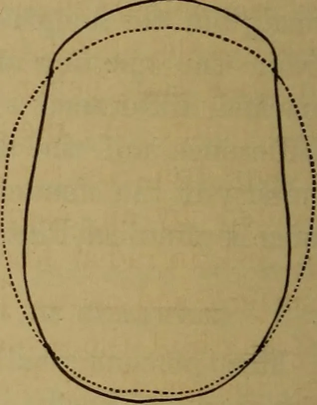 An illustration from Forty years in phrenology; embracing recollections of history, anecdote, and experience, 1882, leaf 397