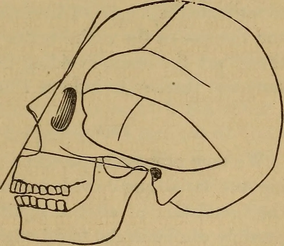 An illustration from Forty years in phrenology; embracing recollections of history, anecdote, and experience, 1882, leaf 404
