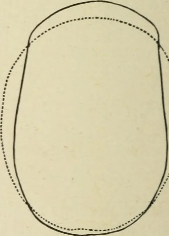 An illustration from Forty years in phrenology; embracing recollections of history, anecdote, and experience, 1882, leaf 397