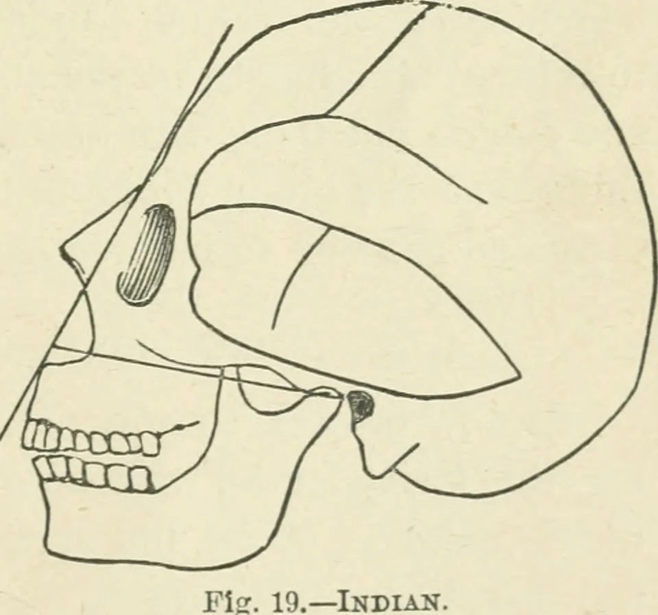 An illustration from Forty years in phrenology; embracing recollections of history, anecdote, and experience, 1882, leaf 404