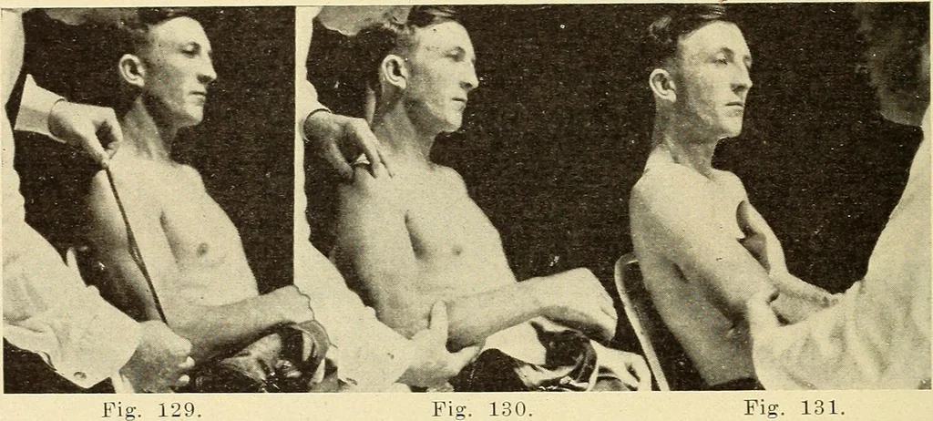 An illustration from Fractures and dislocations, diagnosis and treatment, 1915, leaf 127