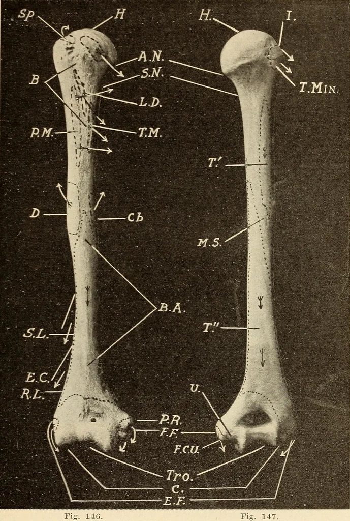 An illustration from Fractures and dislocations, diagnosis and treatment, 1915, leaf 140