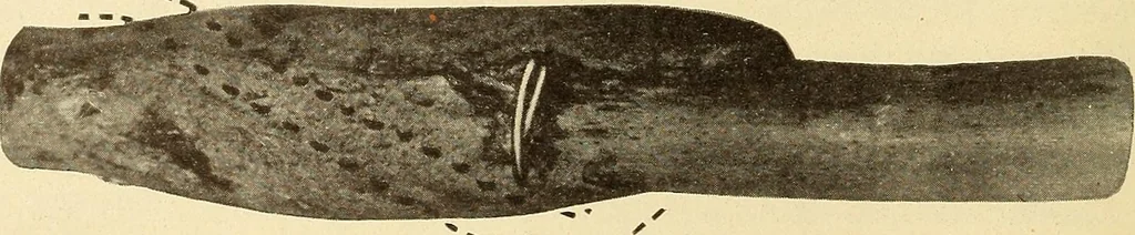 An illustration from Fractures and dislocations, diagnosis and treatment, 1915, leaf 149