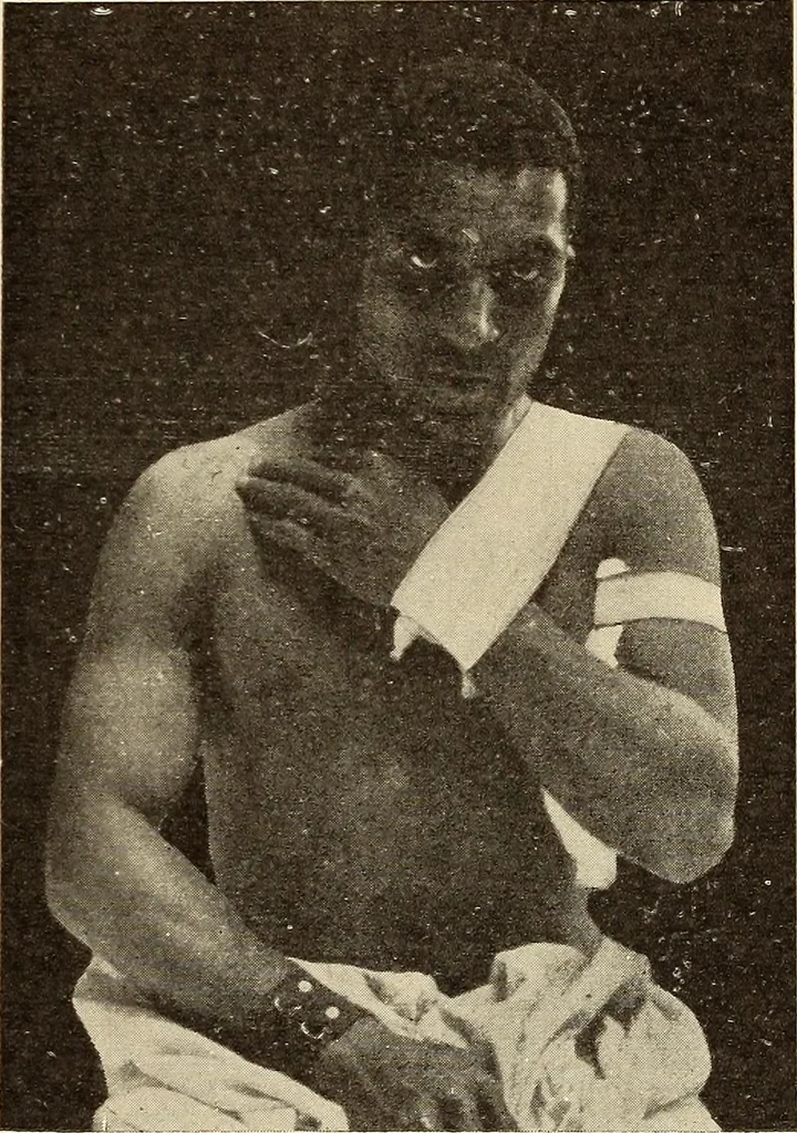 An illustration from Fractures and dislocations, diagnosis and treatment, 1915, leaf 176