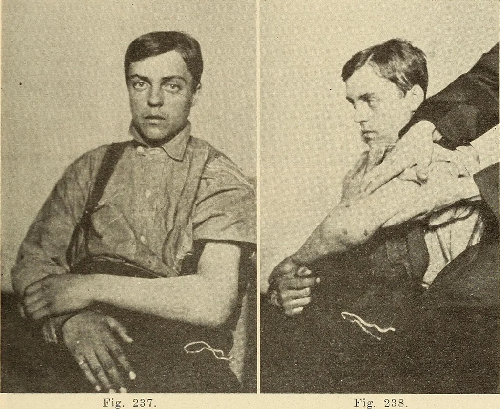 An illustration from Fractures and dislocations, diagnosis and treatment, 1915, leaf 196