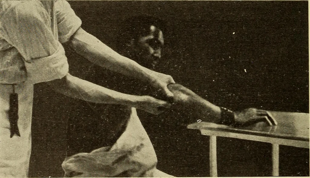An illustration from Fractures and dislocations, diagnosis and treatment, 1915, leaf 199