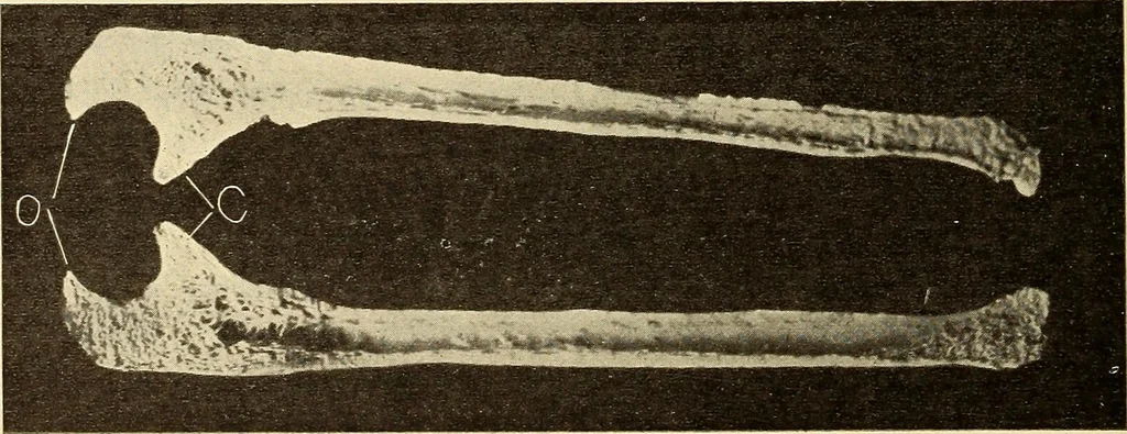 An illustration from Fractures and dislocations, diagnosis and treatment, 1915, leaf 235