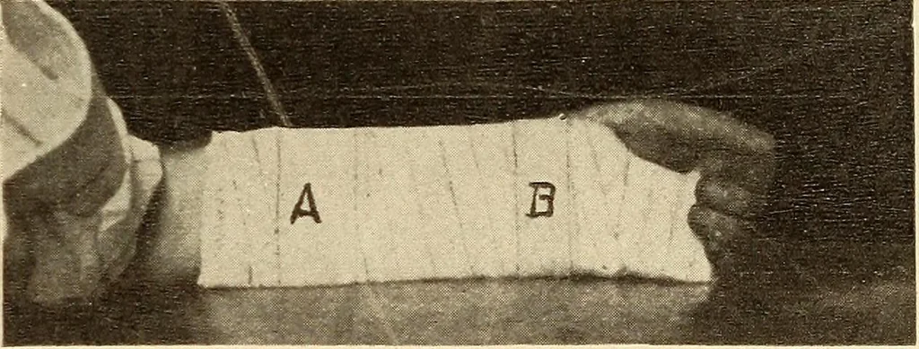 An illustration from Fractures and dislocations, diagnosis and treatment, 1915, leaf 254