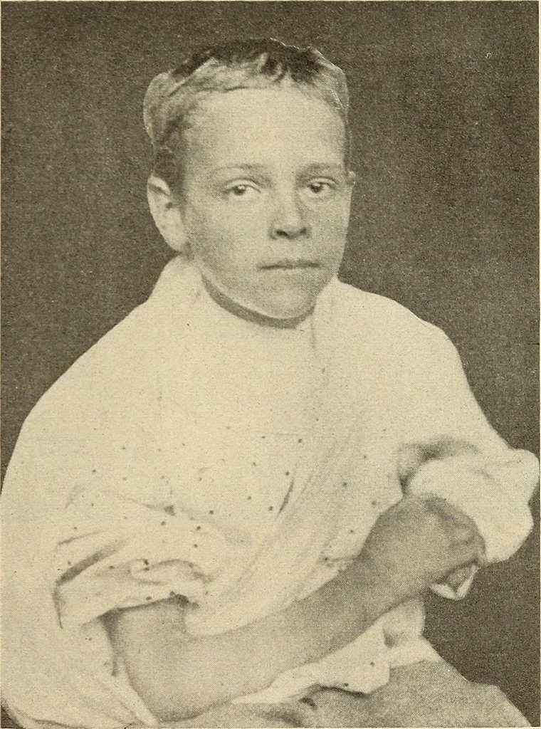 An illustration from Fractures and dislocations, diagnosis and treatment, 1915, leaf 260