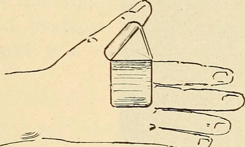 An illustration from Fractures and dislocations, diagnosis and treatment, 1915, leaf 342