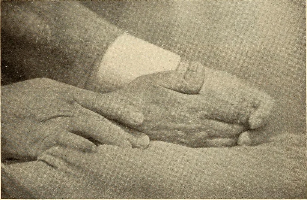 An illustration from Fractures and dislocations, diagnosis and treatment, 1915, leaf 346
