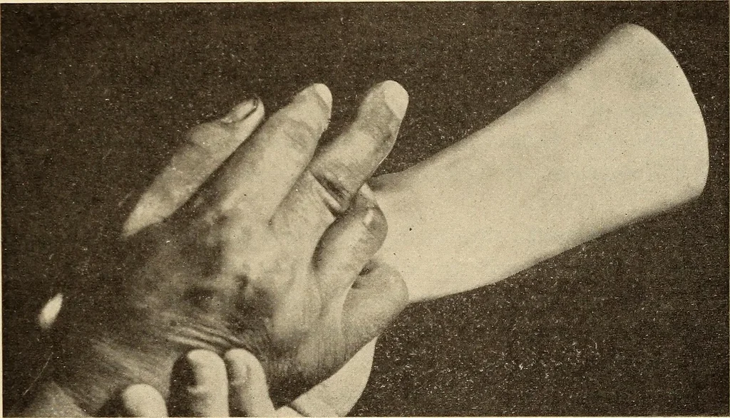 An illustration from Fractures and dislocations, diagnosis and treatment, 1915, leaf 348