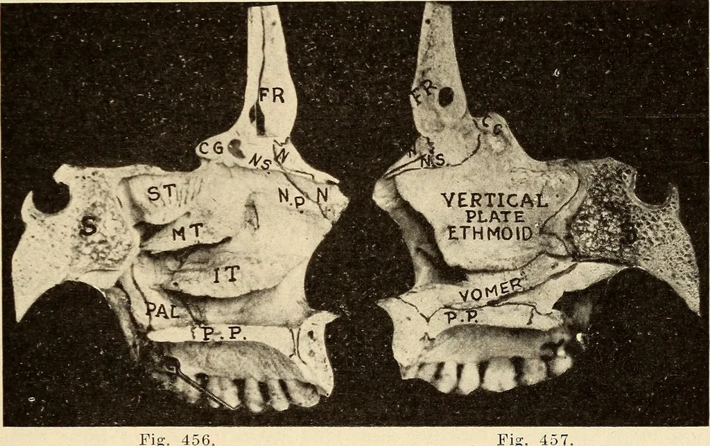 An illustration from Fractures and dislocations, diagnosis and treatment, 1915, leaf 354
