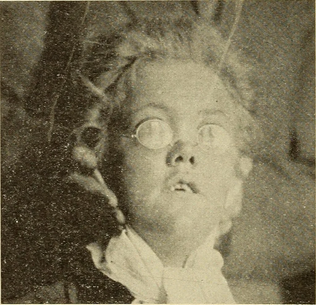 An illustration from Fractures and dislocations, diagnosis and treatment, 1915, leaf 359