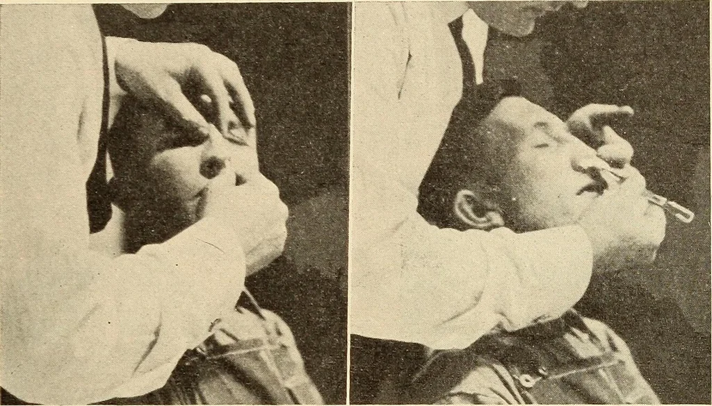An illustration from Fractures and dislocations, diagnosis and treatment, 1915, leaf 360