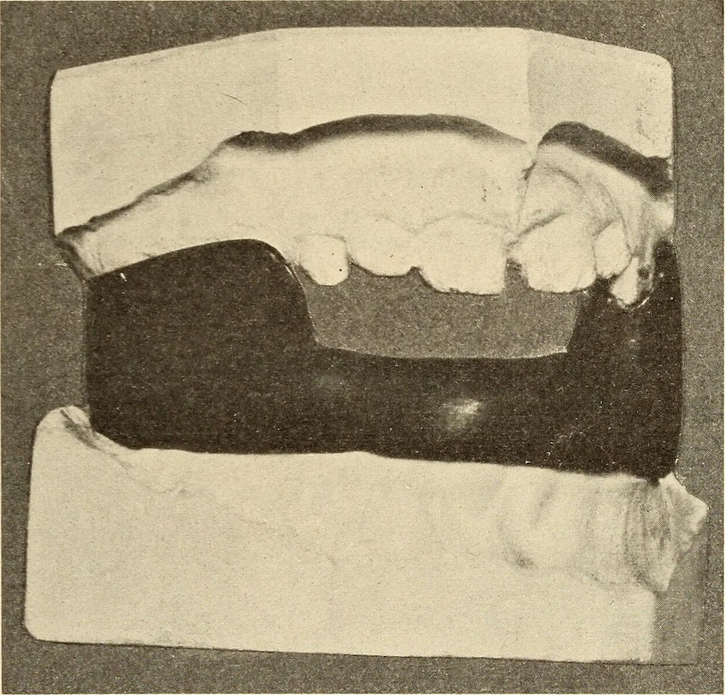An illustration from Fractures and dislocations, diagnosis and treatment, 1915, leaf 390