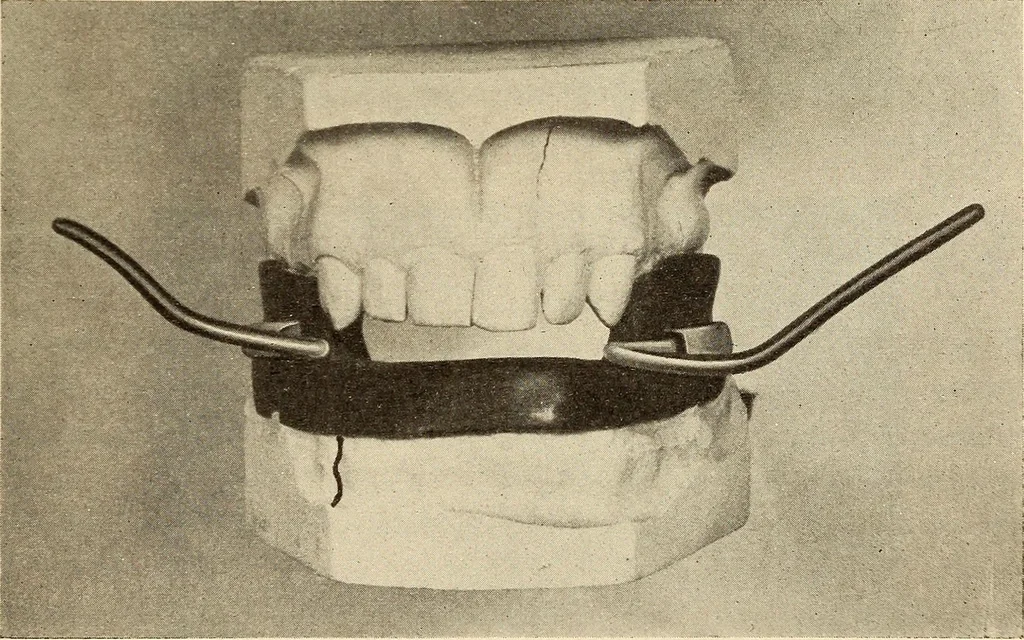 An illustration from Fractures and dislocations, diagnosis and treatment, 1915, leaf 392