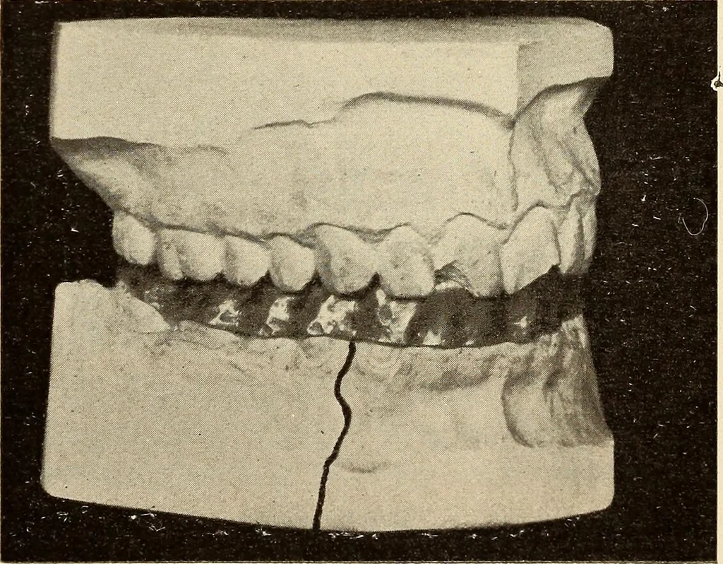 An illustration from Fractures and dislocations, diagnosis and treatment, 1915, leaf 394