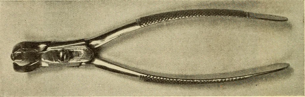 An illustration from Fractures and dislocations, diagnosis and treatment, 1915, leaf 395