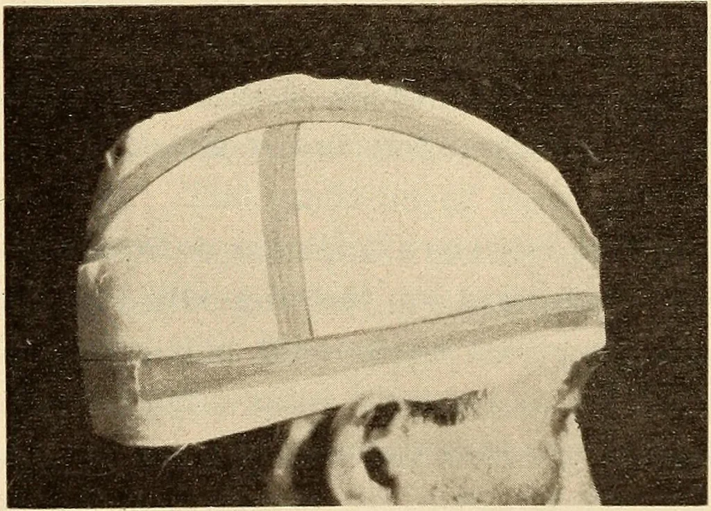 An illustration from Fractures and dislocations, diagnosis and treatment, 1915, leaf 418