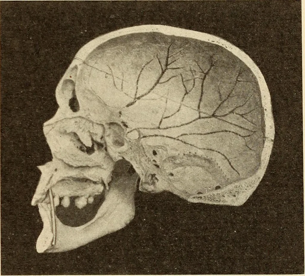 An illustration from Fractures and dislocations, diagnosis and treatment, 1915, leaf 428