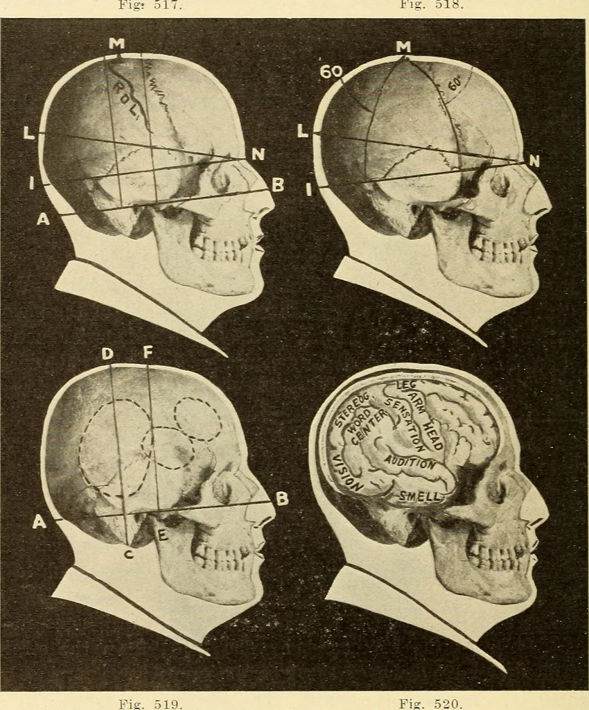An illustration from Fractures and dislocations, diagnosis and treatment, 1915, leaf 431