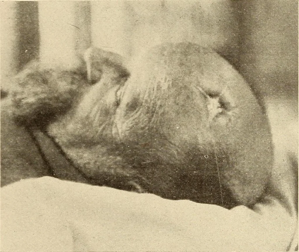 An illustration from Fractures and dislocations, diagnosis and treatment, 1915, leaf 444