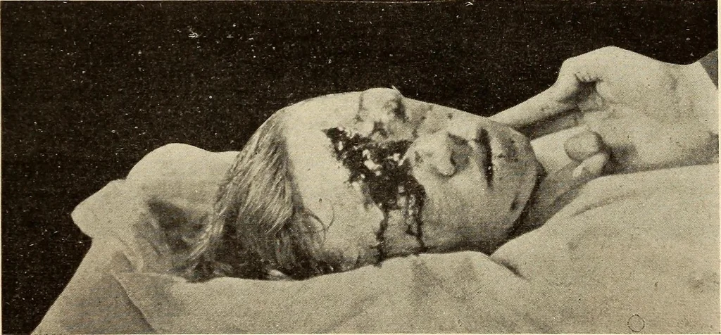 An illustration from Fractures and dislocations, diagnosis and treatment, 1915, leaf 448